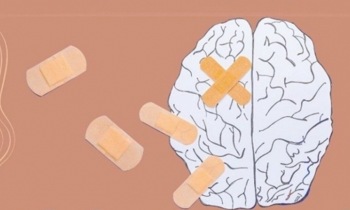 Máme doma Alzheimera!